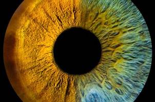 Optografie - Fixierung des letzten Bildes: Was sieht der Mensch vor seinem Tod?