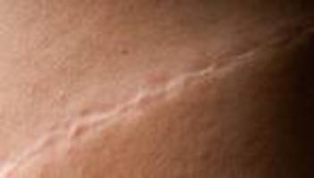 Behandlungsfehler im Krankenhaus: Im Zweifel gegen den Patienten