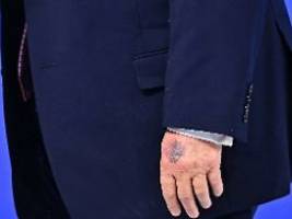 bluterguss wegen friedensrat : weißes haus nennt ungewöhnlichen grund für trumps blaue hand