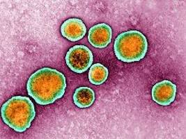 Furcht vor Kinderklink-Füller: RKI sieht RSV-Welle anrollen