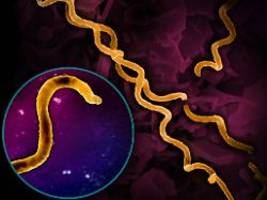 erste pandemie der menschheit?: erreger in 5500 jahre alten knochen gefunden