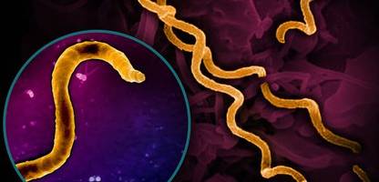 syphilis-erreger in kolumbien: forschende rekonstruieren genom aus 5500 jahre alten knochen