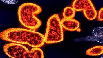 Nipah-Virus-Ausbruch in Indien alarmiert Asien: Flughafenkontrollen verschärft