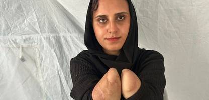 Gaza: Nibal al-Hissi hat beide Hände verloren, ihr Ehemann hat sie verlassen, nun kämpft sie um ihre Tochter
