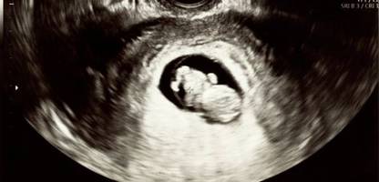 Künstliche Befruchtung: Schwangerschaft in der Petrischale