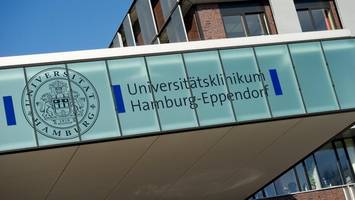 UKE untersucht Cannabis-Konsum seit der Freigabe – mit überraschendem Ergebnis