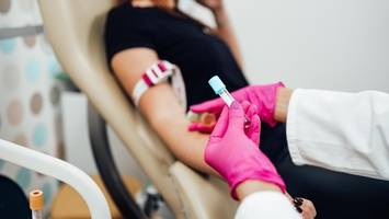 Autorin lässt ihr biologisches Alter berechnen – „bitte nicht in Panik verfallen“