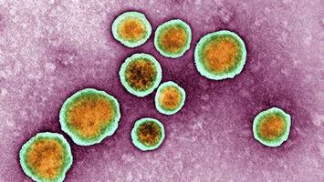 berliner kinderarzt: „ja, die rsv-fälle nehmen sehr stark zu“