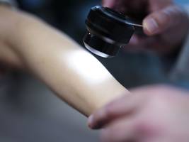 robert-koch-institut: fast jeder zweite deutsche erkrankt an krebs