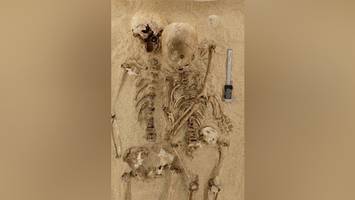 12.000 jahre altes skelett: dna-analyse offenbart seltene krankheit