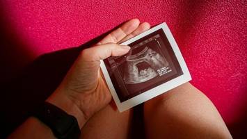 ursache für viele fehlgeburten entdeckt? forscher: „befund ist überzeugend“