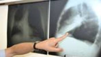 zahlen zu krebserkrankungen: krebsregister: anstieg von krebsfällen in schleswig-holstein