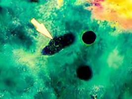 Gefahr wächst durch Klimawandel: Hirnfressende Amöben breiten sich aus