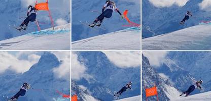 Olympische Winterspiele: Lindsey Vonn darf selbst über ihr Knie und ihren Körper entscheiden