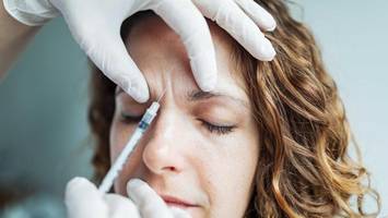 Botox: Die wichtigste Regel zählt erst nach der Behandlung