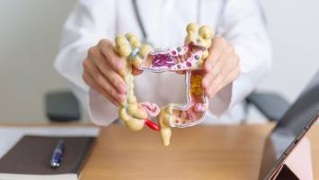 darmkrebs-experte: „chemotherapie für alle – die zeit ist vorbei“