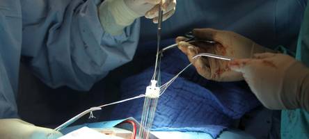 zweijähriger erhält beschädigtes spenderherz: „die zeit drängt, sein zustand ist kritisch“