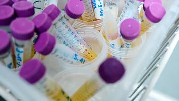 neue funde: auch jugendliche teils massiv mit verbotenem weichmacher belastet