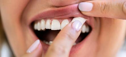 Modedroge unter der Lippe: Was sind Snus und Nikotinbeutel?