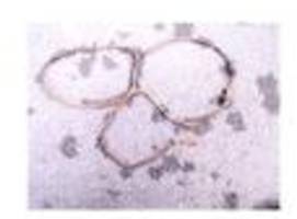 Cold-Case-Ermittlungen: Ungeklärtes Verbrechen: Wer war die gefesselte Frau im See?