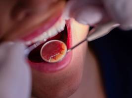 Zahngesundheit: „Am Zustand der Zähne kann man schnell sehen, wie es einer Gesellschaft geht“