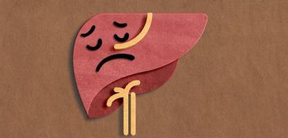 Fettleber: »Wollen Sie mit 65 einen Herzinfarkt haben oder mit Ihren Enkeln spielen?«