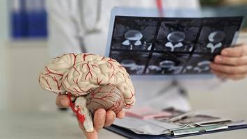 Alzheimer mit Bluttest vorhersagen? Das verspricht die neueste Forschung