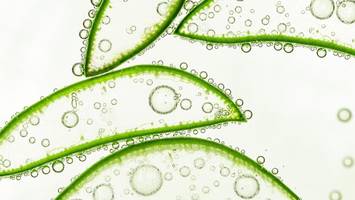 Mit Aloe Vera gegen Alzheimer? Forscher machen Hoffnung