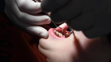 Karies als Kind: Steigt damit das Risiko für Herzerkrankungen?