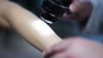 gesundheitsvorsorge: nur knapp ein drittel der menschen nutzt hautkrebs-früherkennung