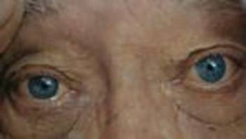 Pflegebedürftigkeit: Viele Pflegebedürftige zahlen zu viel aus eigener Tasche