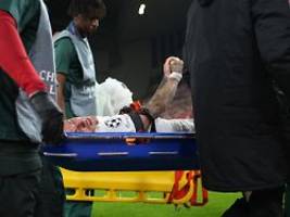 Teil des Fingers verloren?: Galatasaray will bizarre Verletzung nicht auf sich sitzen lassen