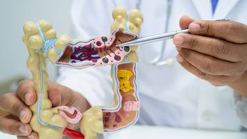 blut im stuhl: ursachen, erkrankungen, vorbeugung