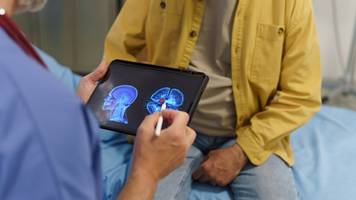 der neurowissenschaftler, der glaubt, dass nichtstun der schlüssel zur senkung des alzheimer-risikos ist