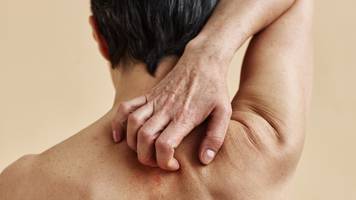 Millionen Deutsche haben Diabetes – 7 Zeichen zeigen, ob Sie dazugehören