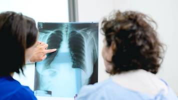 Pleuraerguss: Ursachen, Folgen und wann Sie zum Arzt müssen