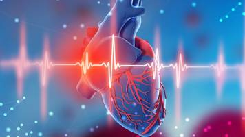 us-mediziner empfehlen 5 neue maßnahmen gegen herzinfarkt