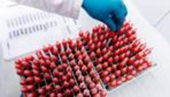 Wissenschaft: Halle baut Kryolager aus – Millionen für Forschung an Proben