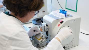 Spitzenforschung in Berlin: So können Krankheiten früher erkannt werden