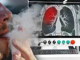 nicht für alle starkraucher: neues lungenscreening soll raucherleben retten