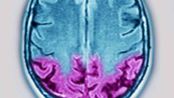 Ataxie: Symptome, Ursachen, Folgen und wann Sie zum Arzt müssen