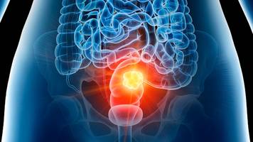 Darmkrebs: Auf zwei Signale achtet ein Arzt bei sich selbst