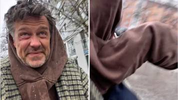 rippe gebrochen: wayne carpendale muss nach fahrrad-sturz ins krankenhaus