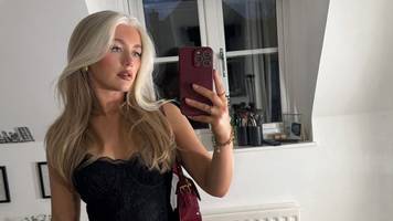 frau (24) mit seltener gen-erkrankung wird wegen weißer haare als „dachs“ gemobbt