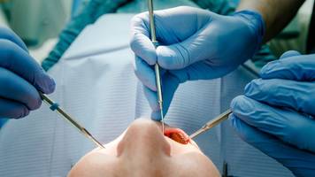 Schneller Zahnersatz ohne Risiko? Zahnärztin erklärt, wann Sofort-Implantate möglich sind