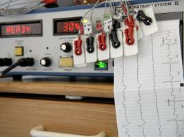 Psychiatrie: Warum Psychiater die Therapie mit Stromschlägen verteidigen