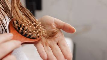 Berliner Charité: Haartest soll zeigen, um wie viel Uhr Medikamente am besten wirken