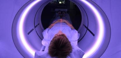 Lungenkrebs-Screening: Wie Hochrisiko-Patienten von Früherkennung profitieren