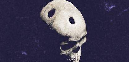 steinzeit: schädel mit löchern – warum steinzeit-Ärzte so oft in köpfe bohrten