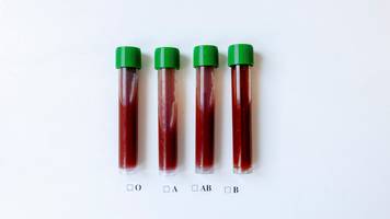 Ob Covid, Malaria oder Herz-Kreislauf-Erkrankungen: Je nach Blutgruppe verändert sich das persönliche Krankheitsrisiko, zeigen Studien